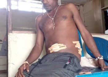 Ferianus Asso, Korban Tembak di Dekai Meninggal Dunia