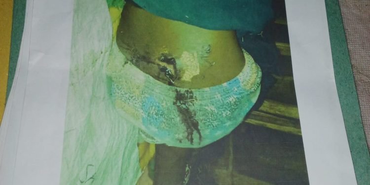 Urgent: Parina Karunggu Butuh Evakuasi dan Penangan Medis