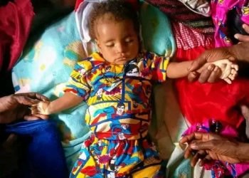 Anak Satu Tahun Ini  Dilaporkan Meninggal di Kamp Pengungsian Yahukimo