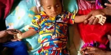 Anak Satu Tahun Ini  Dilaporkan Meninggal di Kamp Pengungsian Yahukimo